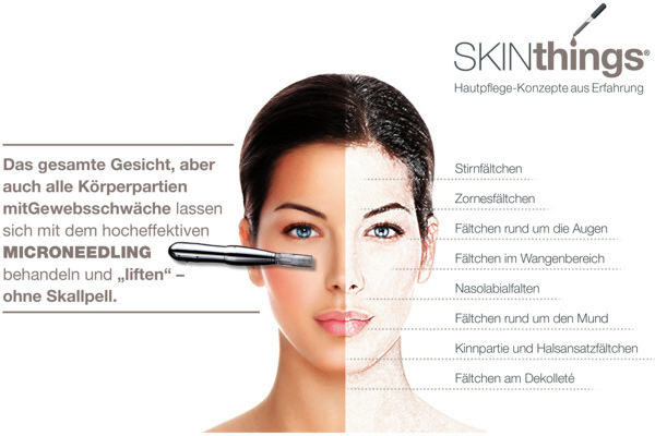 MicroNeedling